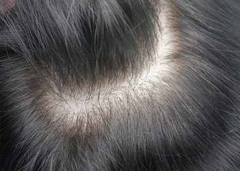 hs7m-en-stock-pour-livraison-immediate-03-small_orig