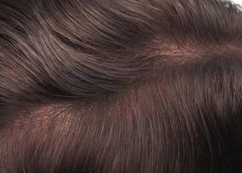 sw-3-ultra-thin-skin-0-03mm-human-hair-stock-toupee-5-1_orig